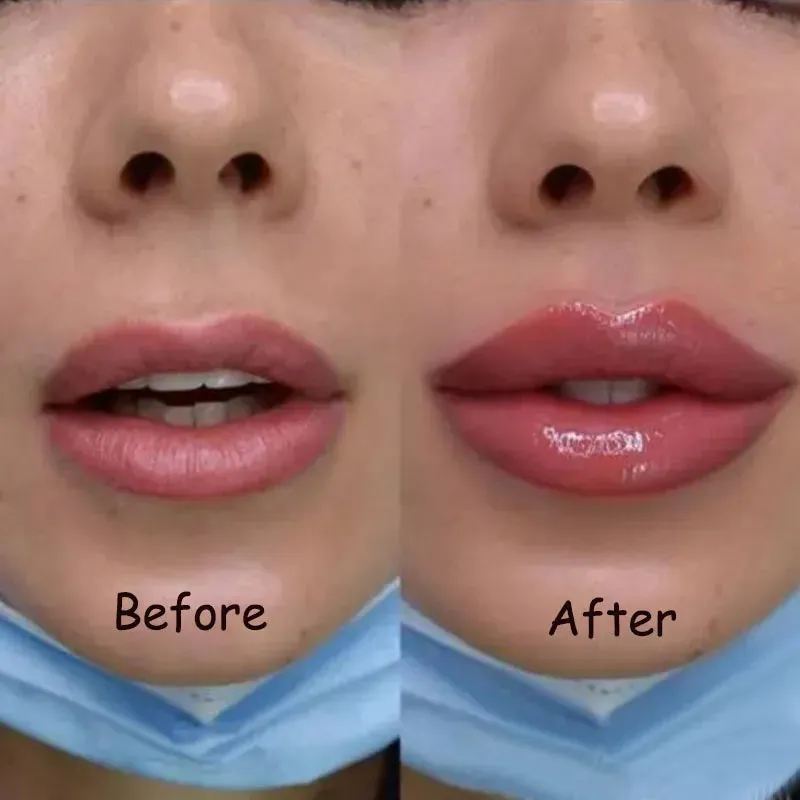 Revitalize Your Lips with our Instant Volumizing Lip Plump Serum: Enhance Elasticity, Diminish Fine Lines, and Nourish for Sensuous Beauty Lip Care.
